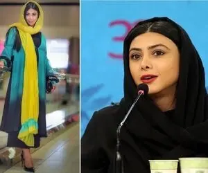 قبل و بعد آزاده صمدی / عمل بینی قبل ازدواج جادو کرد واسش بعد عروسی گرفت زبانزد