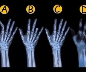 بازی فکری؛ مغز پلیست رو به کار بکش و بگو کدوم از این MRI برای جسد؟