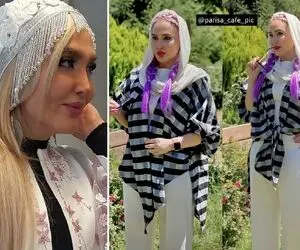 "زهره فکور" پیش دکتر جون کم پلنگ شد با فتوشاپم زد ترکوند؛ شما کِی مدل شدی!