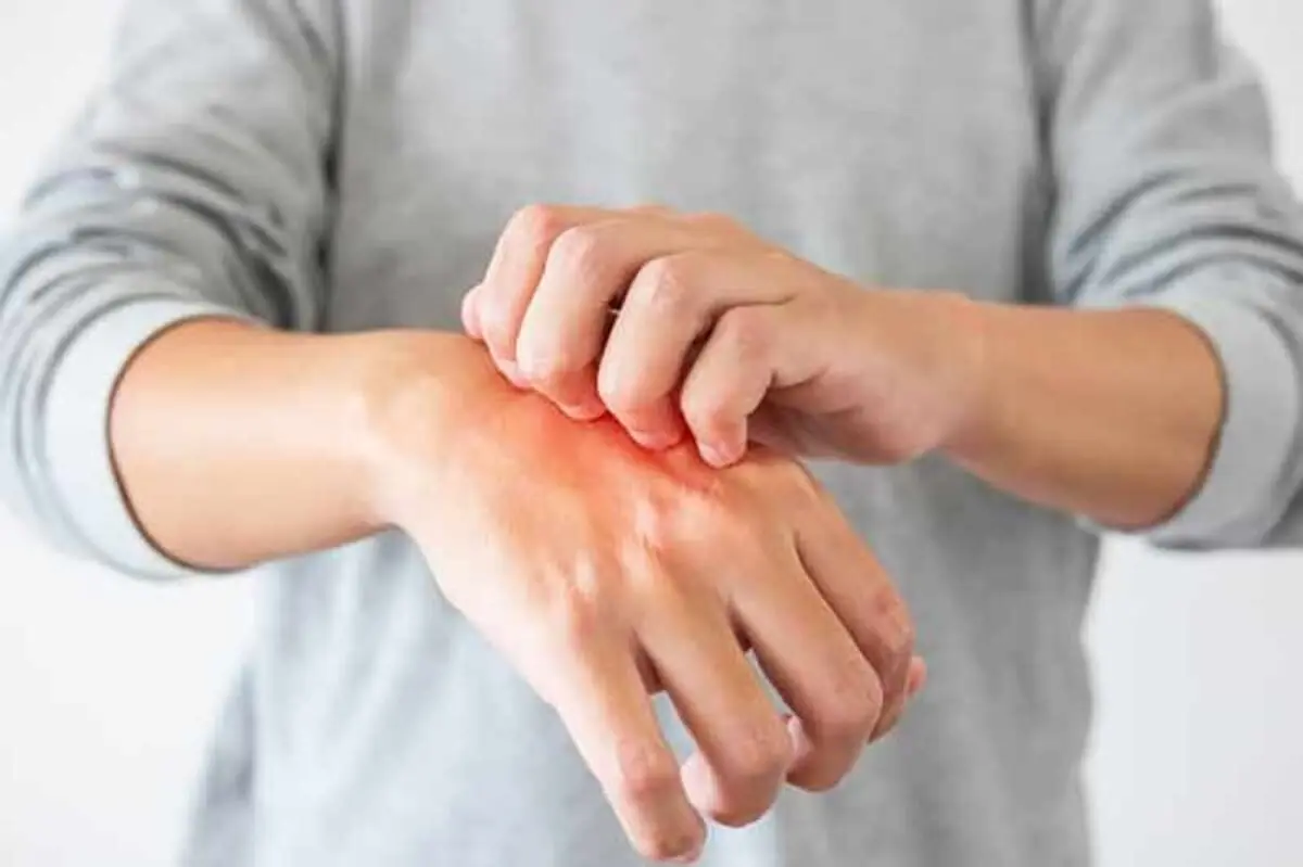 پوست-خشک-و-خارش-دار