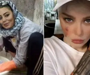 فرق سحر قریشی چهل ساله با نوزده ساله / رفت یو اس خوره شهرت صورتشو خط خطی کرد